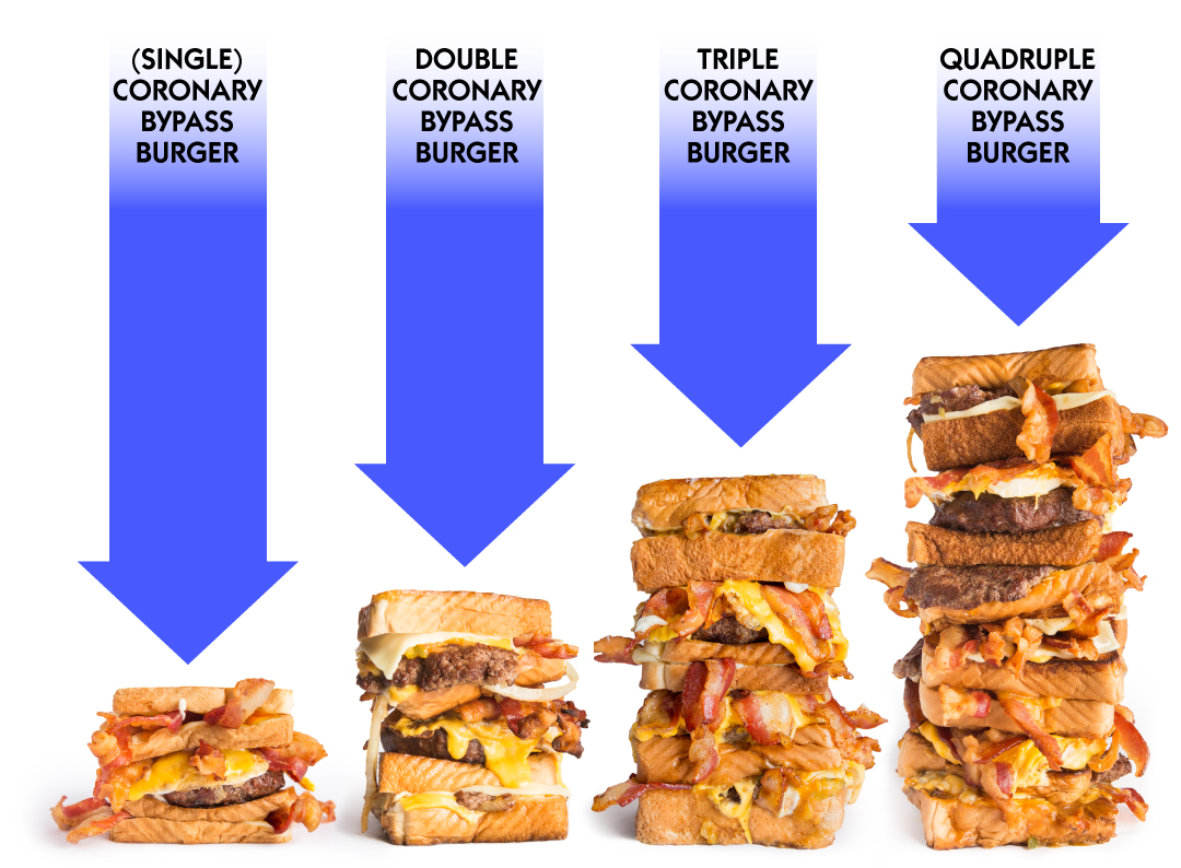 coronary_progression2_tighter.jpg